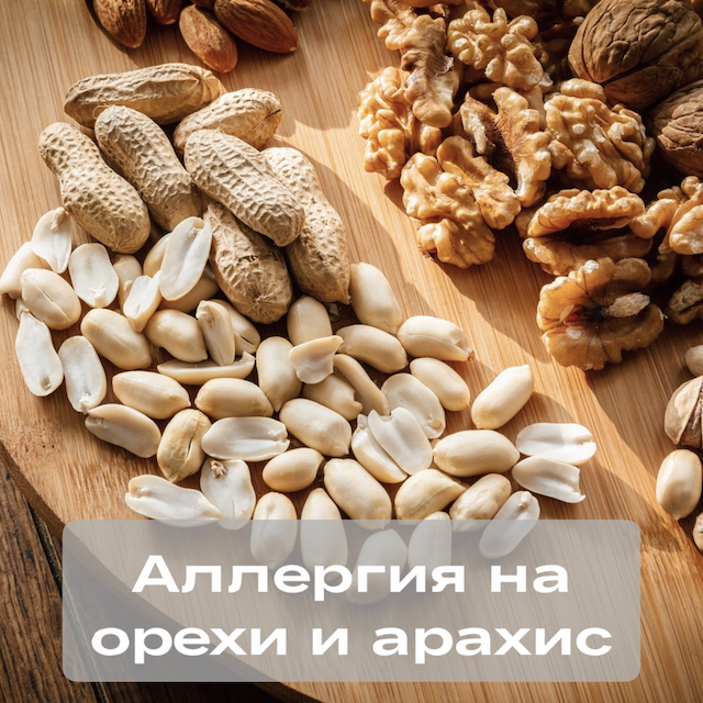 Молекулярная диагностика аллергии на орехи и арахис